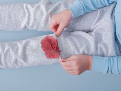 Λεκές από αίμα: Κρύο ή ζεστό νερό πρέπει να χρησιμοποιήσετε;