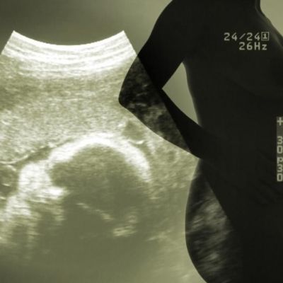 8 πράγματα που πρέπει να ξέρετε αν θέλετε να μείνετε έγκυος