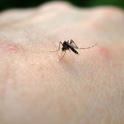 Αντιμετωπίστε τα τσιμπήματα του καλοκαιριού