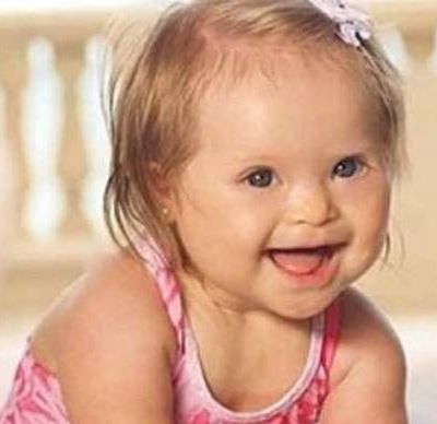 Κοριτσάκι με σύνδρομο Down πρωταγωνιστεί σε διαφημιστική καμπάνια μαγιό