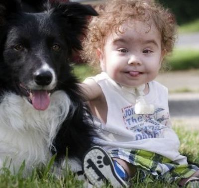 Τρισδιάστατη εκτύπωση ζωτικού οργάνου, έσωσε τη ζωή ενός μωρού!