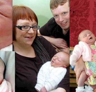 Κι όμως γεννήθηκαν με δύο μπροστινά δόντια!