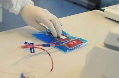 Για πρώτη φορά παιδί με εγκεφαλική παράλυση θεραπεύεται με βλαστοκύτταρα!