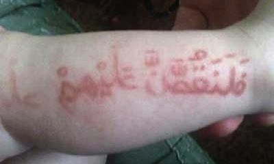 Μητέρα εκμεταλλεύεται την αλλεργία του βρέφους της, παρουσιάζοντάς το ως «Προφήτη» (εικόνες)