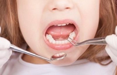 Η σημασία της καλής υγιεινής των πρώτων δοντιών