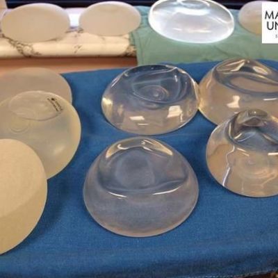 Δεκάδες κρούσματα καρκίνου του μαστού από εμφυτεύματα στήθους