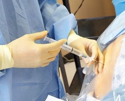 Ο γυναικολόγος του Mothersblog μας ενημερώνει για την επισκληρίδιο αναισθησία στον τοκετό!