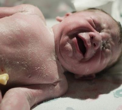 Μηκώνιο: Μια άγνωστη λέξη, σημαντική για τον τοκετό, από τον γυναικολόγο του Mothersblog