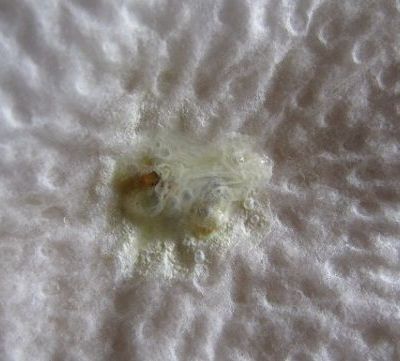 Λεκές από κουτσουλιά; Δείτε πώς θα τον αφαιρέσετε από τα ρούχα!