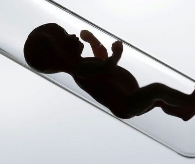 Εξωσωματική γονιμοποίηση: Όλα όσα πρέπει να γνωρίζετε από τον γυναικολόγο του Mothersblog