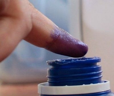 Λεκές από μελάνι στα ρούχα του παιδιού;Κανένα πρόβλημα