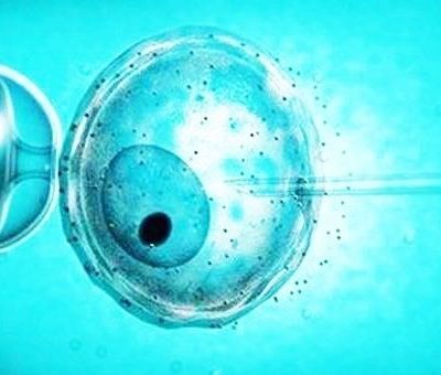 Σπερματέγχυση: Όλα όσα θέλετε να ρωτήσετε το γιατρό σε ένα βίντεο