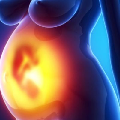 Επιπωματικός (placenta previa) και επιχείλιος πλακούντας: Όλα όσα πρέπει να γνωρίζετε