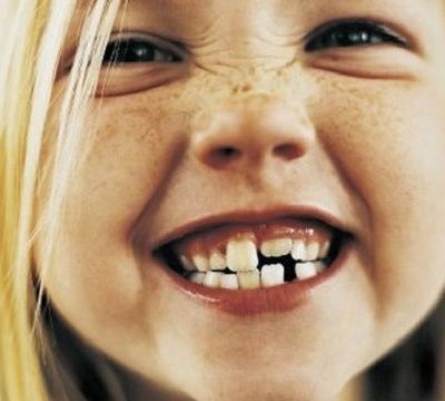 Ποια η σχέση της διατροφής με τη στοματική υγεία των παιδιών;