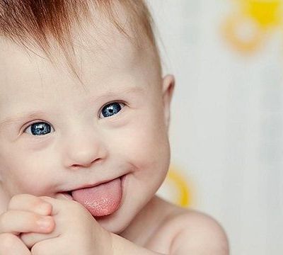 Νέα μέθοδος προγεννητικού ελέγχου για το Σύνδρομο Down (εξωκυττάριο εμβρυϊκό DNA - cell free fetal DNA)