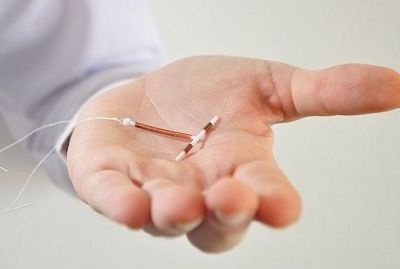 Πώς και πότε ο γυναικολόγος εισάγει το ενδομήτριο σπείραμα (σπιράλ);