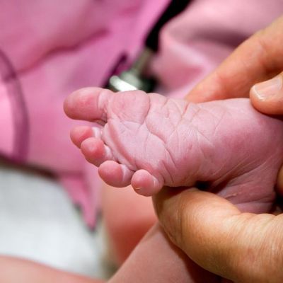 Τι είναι το Apgar Score;