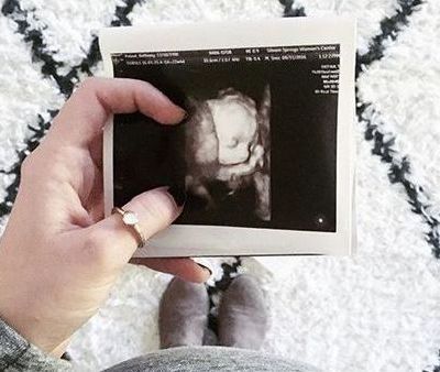 Πότε βλέπουμε για πρώτη φορά το μωρό με υπερηχογράφημα; (vid)