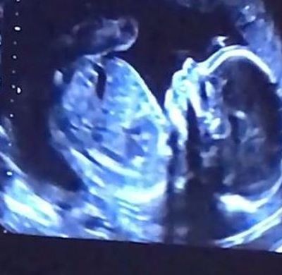 Το βίντεο από την επίσκεψή της στο γυναικολόγο και το υπερηχογράφημα του γιου, που περιμένει!