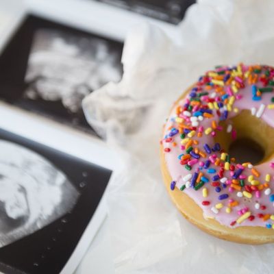 Πώς οι υψηλές ποσότητες ζάχαρης στην εγκυμοσύνη αυξάνουν τις πιθανότητες για παιδικό άσθμα