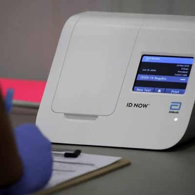 Κορονοϊός: Τεστ αντισωμάτων – Τα πλεονεκτήματα και οι περιορισμοί