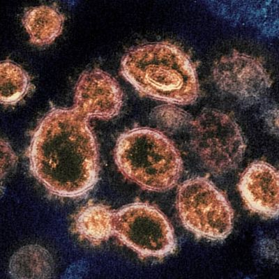 Ο κορονοϊός μπορεί να επιβιώσει ακόμη και 28 ημέρες σε διάφορες επιφάνειες