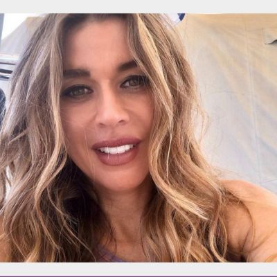 Πρεζεράκου: Συγκλονίζει περιγράφοντας την καθημερινότητά της με το ακρωτηριασμένο χέρι