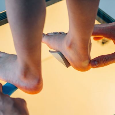 Πελματογράφημα και ορθοτικά (πάτοι) στα παιδιά