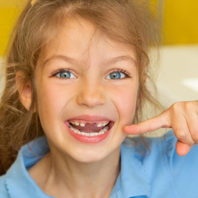 Βρυγμός στα παιδιά: Όσα πρέπει να γνωρίζετε για το τρίξιμο των δοντιών