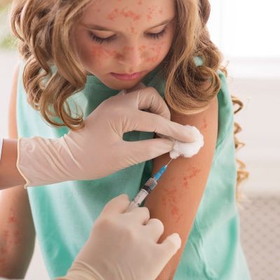 Ιλαρά: Αυξάνονται τα κρούσματα - Ποιοι πρέπει να εμβολιαστούν