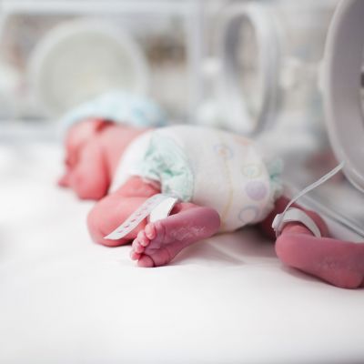 Έρευνα: Τα πλαστικά που βρίσκονται σε καθημερινά προϊόντα προκαλούν αύξηση των πρόωρων τοκετών