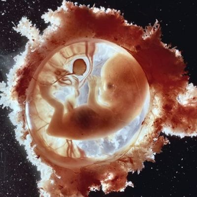 H ανάπτυξη του μωρού μέσα στη μήτρα μέσα από εκπληκτικές φωτογραφίες