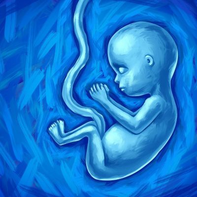 Αιτίες εμβρυϊκού θανάτου - Ο γυναικολόγος συμβουλεύει