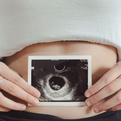 Έμβρυο 12 εβδομάδων: Διακρίνεται το φύλο του μωρού;