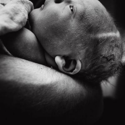 Lanugo - Το πρώτο χνούδι με το οποίο γεννιέται το μωρό (εικόνες)