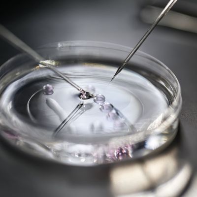 Το ημερολόγιο της εξωσωματικής γονιμοποίησης: Όλα τα βήματα