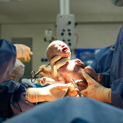 Γεννήθηκε στο Ηνωμένο Βασίλειο το πρώτο μωρό από μεταμοσχευμένη μήτρα