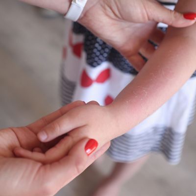 Τι βάζουμε στο κάψιμο;