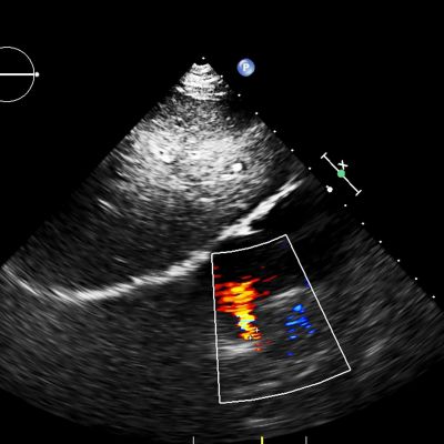 Επιστήμονες κατέγραψαν για πρώτη φορά σε εικόνες τον σχηματισμό καρδιάς σε έμβρυο (βίντεο)