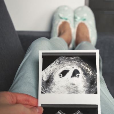 Σημεία «Τ» και «λ» στον υπέρηχο: Τι αποκαλύπτουν για τα δίδυμα