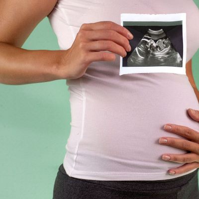 Δίδυμη κύηση: Πότε φαίνεται στον υπέρηχο;