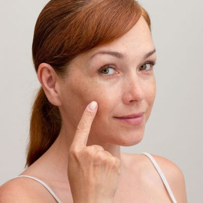 Πανάδες: Φυσικές θεραπείες που λειτουργούν