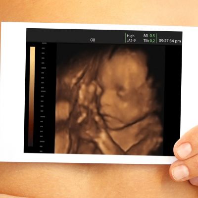 Καρδιοτοκογράφημα (Non-Stress Test/ NST): Μια ασφαλής και απλή μέθοδος παρακολούθησης του εμβρύου