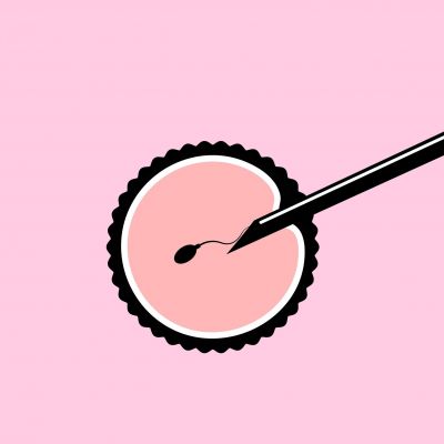 Εξωσωματική γονιμοποίηση: 10 πράγματα που πρέπει να ξέρετε πριν ξεκινήσετε