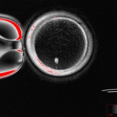 Ελπίδα για τα υπογόνιμα ζευγάρια: Δημιουργία ανθρώπινων εμβρύων από κύτταρα δέρματος