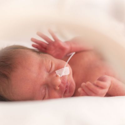 Προωρότητα: Τα συγκλονιστικά στοιχεία για την Ελλάδα και οι πιο γλυκές φωτογραφίες μικρών μαχητών