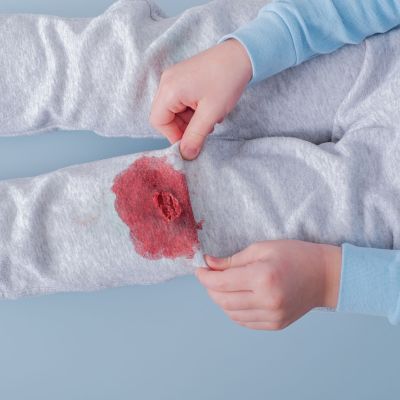 Λεκές από αίμα: Κρύο ή ζεστό νερό πρέπει να χρησιμοποιήσετε;