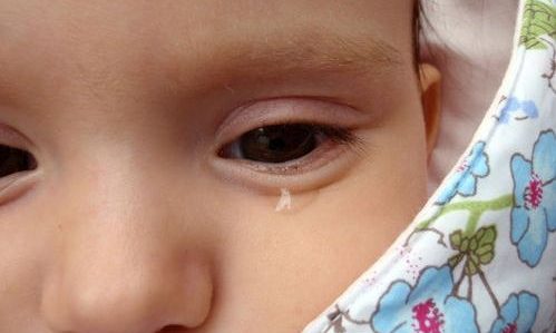 Σοκαριστικό: Mωρό Κύκλωπας γεννήθηκε στην Αίγυπτο