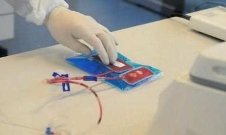 Για πρώτη φορά παιδί με εγκεφαλική παράλυση θεραπεύεται με βλαστοκύτταρα!