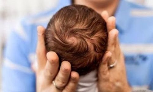 «Πάμε στο γιατρό και μου κάνει διάγνωση ινομύωμα 7 εκατοστά. Άμεσα χειρουργείο και φόβος για αφαίρεση μήτρας»